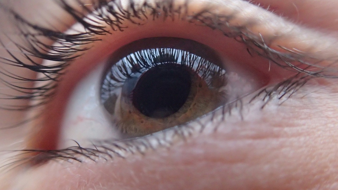 Cataract What Are They, Causes , Risk Factors And Treatment Options