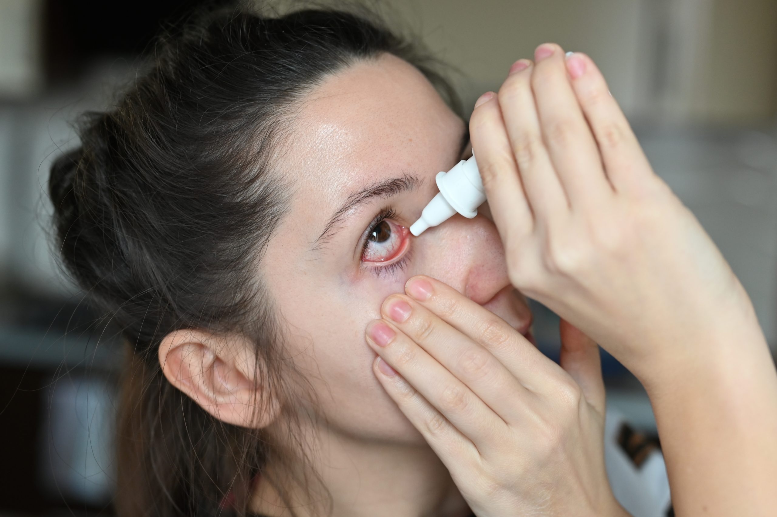 What To Do When You Have An Acute Infection To The Eye