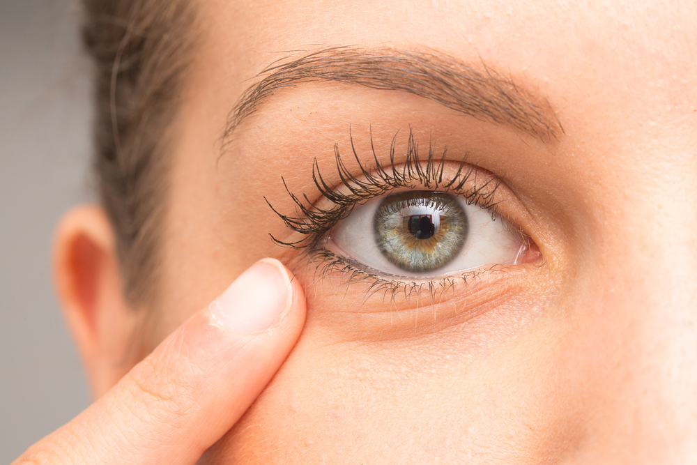 Can entropion be treated without surgery